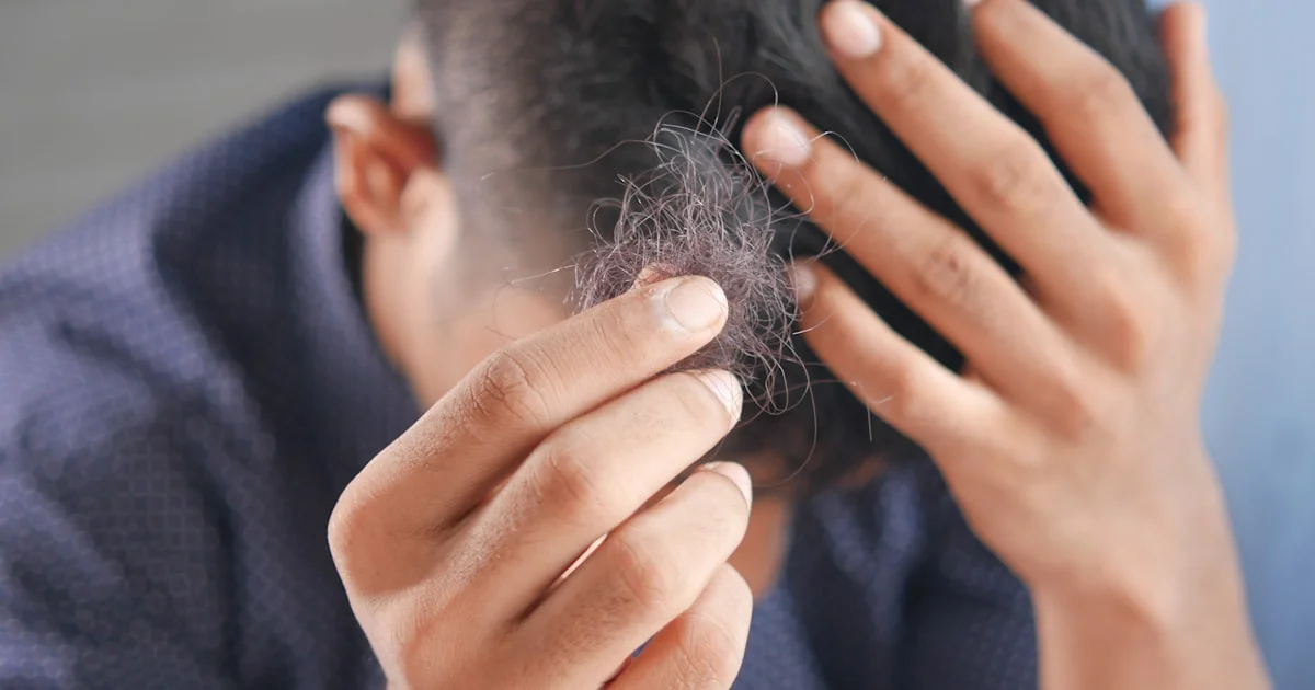 A man checking thinning hair at his hairline, the pattern hair loss a hair growth laser device is meant to treat
